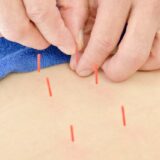 腰痛鍼灸｜慢性的な腰の痛み・繰り返す腰痛でお悩みの方へ：てて整骨院二十四軒店