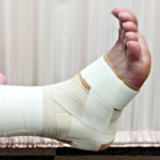 札幌西区琴似周辺で足首の捻挫をした時は(前距腓靭帯損傷)