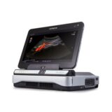 札幌市西区で安心のエコー診察｜ ケガや痛みを“見える化”する超音波観察【てて整骨院二十四軒店】